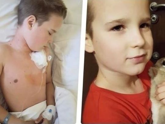 10-letni Kacper z Włocławka walczy o życie. Potrzeba jeszcze blisko czterech milionów
