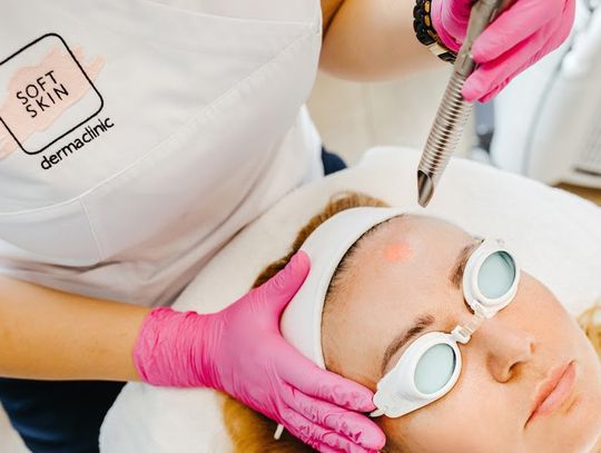 Laserowe odmładzanie twarzy - resurfacing, endolifting Fotona 4D