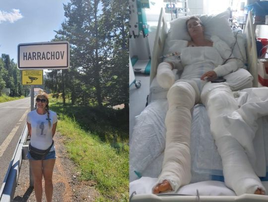 "Mama stanęła w płomieniach, przeszła piekło."  Zbiórka dla kwiaciarki z Włocławka