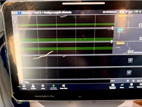 Nowy sprzęt za 500 000 zł trafił na oddział intensywnej terapii do włocławskiego szpitala