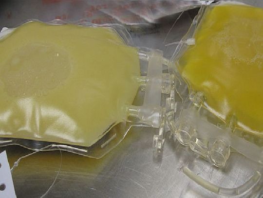 Pierwszy ozdrowieniec z Włocławka oddał osocze krwi dla chorych na COVID-19:"Mam nadzieję że moje osocze pomoże chorym w leczeniu tego dziadostwa."