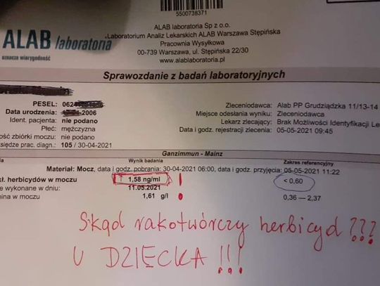 Włocławianka apeluje do prezydenta w sprawie toksycznej substancji. Obecność glifosatu wykryto w organizmie jej dziecka 