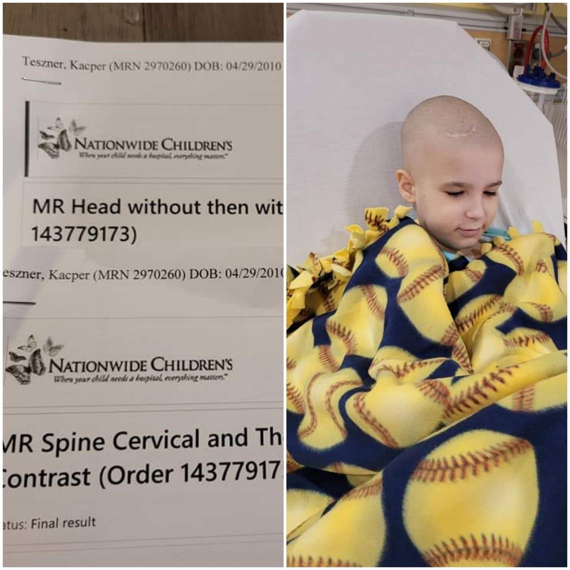 Kacperek po rezonansie."Jest czysto"! Trwa oczekiwanie na wzrost płytek krwi