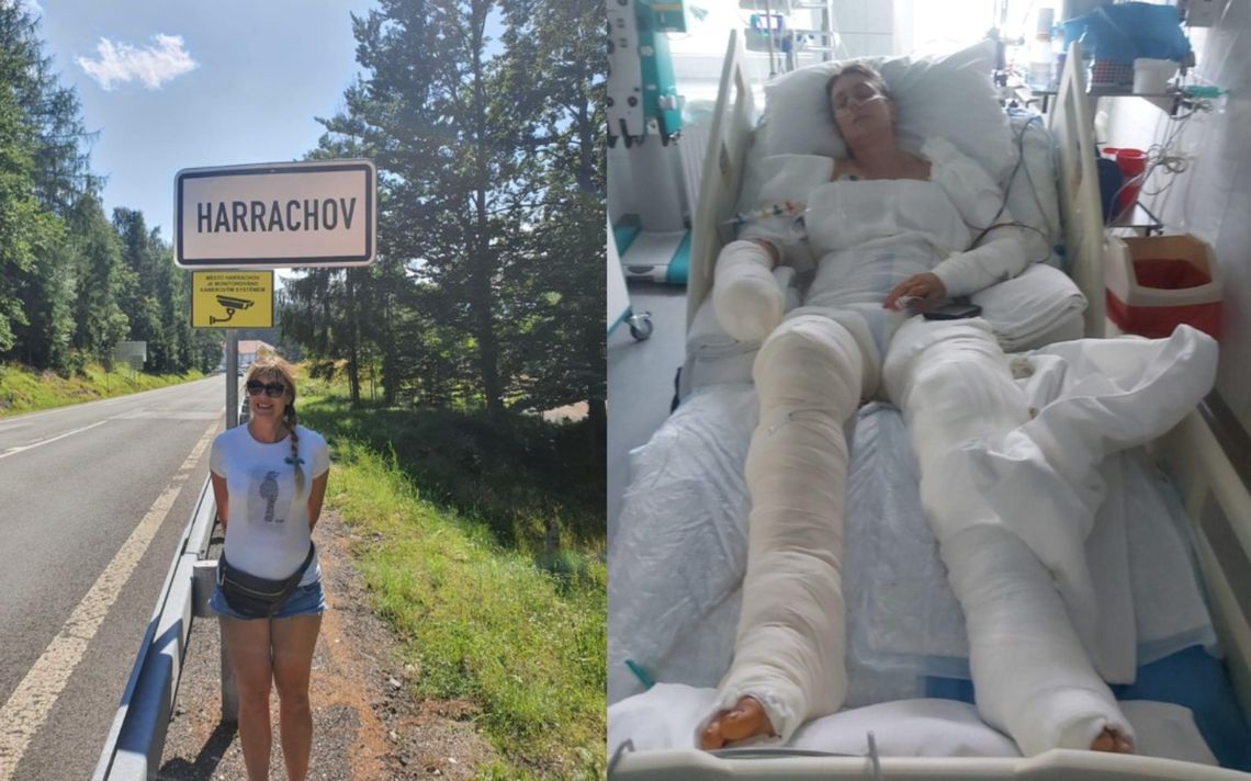 "Mama stanęła w płomieniach, przeszła piekło."  Zbiórka dla kwiaciarki z Włocławka