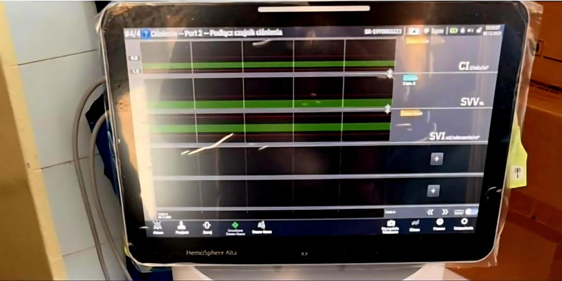 Nowy sprzęt za 500 000 zł trafił na oddział intensywnej terapii do włocławskiego szpitala Nowy sprzęt za 500 000 zł trafił na oddział intensywnej terapii do włocławskiego szpitala