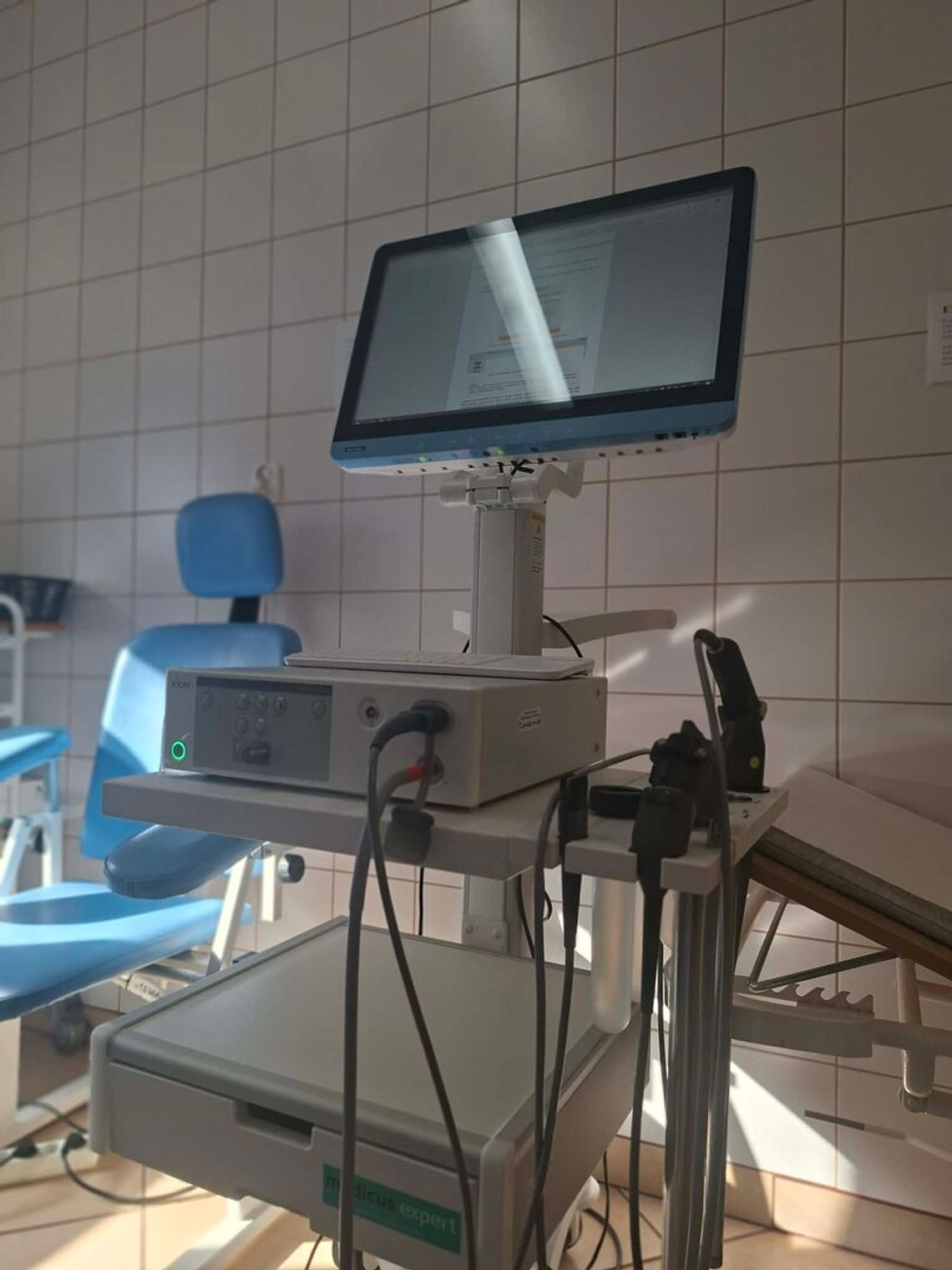 Oddział Otolaryngologii, Chirurgii Głowy i Szyi ma nowy sprzęt. Urządzenie pozwala na ocenę struktur nosa, gardła i krtani