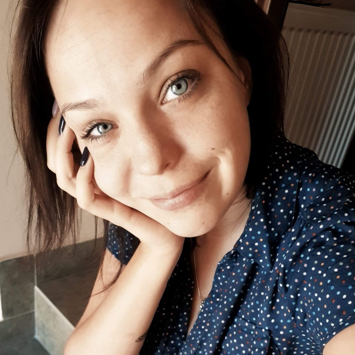 To moja jedyna i ostatnia deska ratunku. Włocławianka zbiera na skomplikowaną operację 